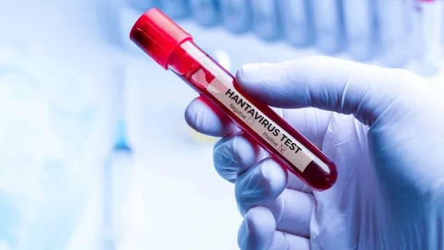 Hantavírus Pode Permanecer No Sêmen Por Até Seis Anos, Diz Estudo hantavirus-pode-permanecer-no-semen-por-ate-seis-anos,-diz-estudo