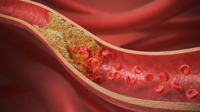 10 Alimentos Que Cardiologistas Indicam Para Baixar O Colesterol 10-alimentos-que-cardiologistas-indicam-para-baixar-o-colesterol