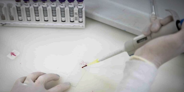 Paciente em SP com suspeita de ebola testa positivo para meningite paciente-em-sp-com-suspeita-de-ebola-testa-positivo-para-meningite